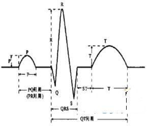 T波的改变 间接性t波改变咋回事