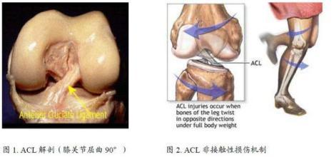 前交叉韧带损伤的防治 前交叉韧带损伤 痊愈