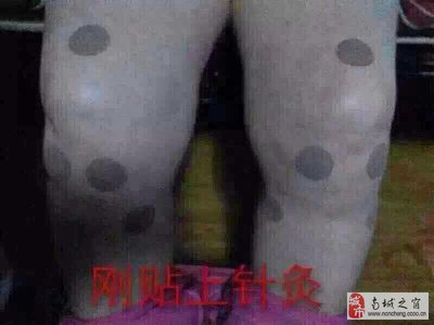 脚肿是什么原因|怎么办 腿肿脚肿是怎么回事