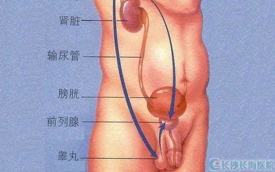 怎样保养前列腺 前例腺炎怎么治疗