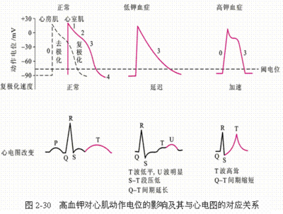 高钾血症的危害 高钾血症心肌