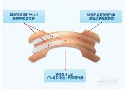 鼻子不通气应该怎么办？ 感冒鼻子不通气怎么办