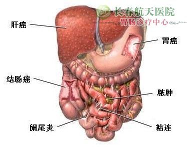 肚子左边疼怎么办？ 女人左边小肚子疼