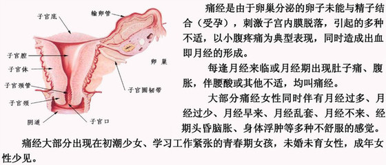 女人痛经怎么办快速解决 女孩子治痛经的小方法