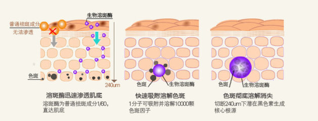 祛斑产品排行榜10强 淡斑产品排行榜10强