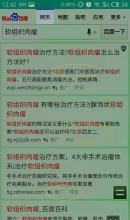  魏则西事件是怎么回事 百度“魏则西事件”，让我想起小小“微平台”的心酸