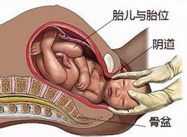  weblogic补丁升级指导 指导产业升级靠脑袋不靠屁股