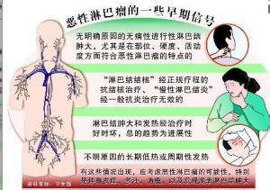  生命不能承受之轻 生命不能承受的淋巴瘤