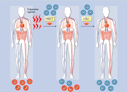 造血干细胞移植 造血干细胞移植-简介，造血干细胞移植-造血干细