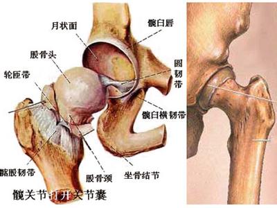 骨头坏死 骨头坏死-股骨头坏死的概述，骨头坏死-股骨头坏死的病