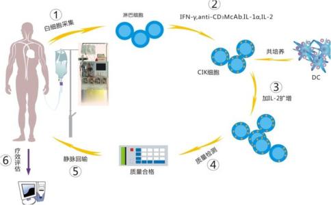 细胞免疫疗法 细胞免疫疗法-发展，细胞免疫疗法-分类