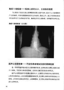 风心病症状 心病 心病-概要，心病-症状