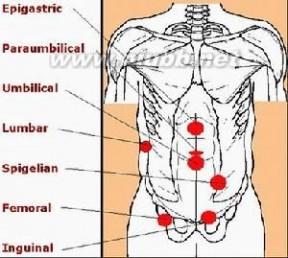 疝气 疝气-病因介绍，疝气-病理解剖