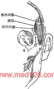 颞间隙感染 颞间隙感染 颞间隙感染-诊断，颞间隙感染-治疗措施