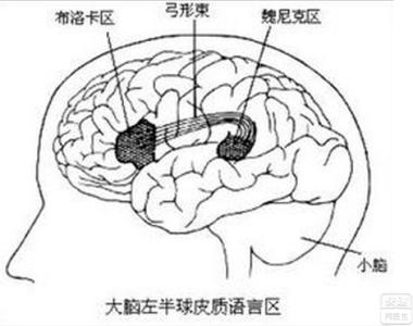 传导性失语症 传导性失语症-简介，传导性失语症-病因