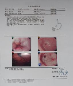 反流性食道炎症状 反流性食道炎 反流性食道炎-简介，反流性食道炎-症状