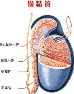 输精管堵塞的原因 输精管堵塞 输精管堵塞-概述，输精管堵塞-原因