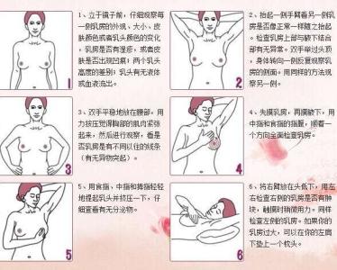 乳腺癌是怎么引起的 怎样避免乳腺癌