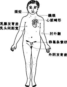 先天性卵巢发育不全 先天性卵巢发育不全 先天性卵巢发育不全-概述，先天性卵巢发育不