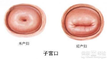 慢性宫颈炎病理改变 慢性宫颈炎 慢性宫颈炎-病因学，慢性宫颈炎-病理改变