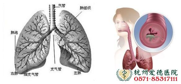 病毒性脑膜炎病因 病毒性肺炎 病毒性肺炎-概述，病毒性肺炎-病因