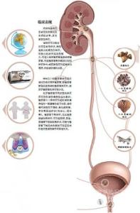 医学术语翻译 多尿 多尿-医学术语，多尿-病因