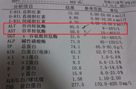 谷丙转氨酶偏高的原因 谷丙转氨酶偏高是什么原因