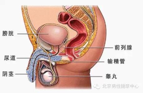 阴囊精索静脉曲张 阴囊精索静脉曲张 阴囊精索静脉曲张-疾病概述，阴囊精索静脉曲张