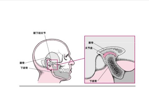 颞下颌关节紊乱综合征 颞下颌关节紊乱综合征 颞下颌关节紊乱综合征-病因，颞下颌关节紊