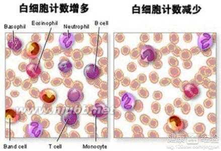 中性粒细胞百分比 中性粒细胞百分比 中性粒细胞百分比-简介，中性粒细胞百分比-致