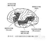 命名性失语症治疗资料 完全性失语 完全性失语-介绍，完全性失语-参考资料