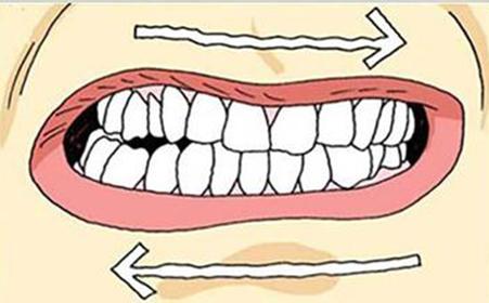 小孩磨牙是什么原因 磨牙是什么原因