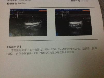 临床医学英语术语速记 彩超[医学术语] 彩超[医学术语]-彩超特点，彩超[医学术语]-临床