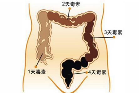 如何清理体内宿便 宿便 宿便-错误认识，宿便-如何清理