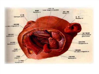 颌下腺结石 涎石病 涎石病-简介，涎石病-下颌下腺结石