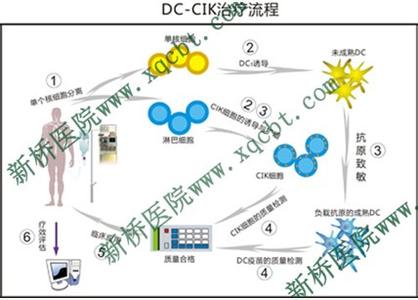 dc cik细胞免疫治疗 CIK生物免疫治疗 CIK生物免疫治疗-走进科学扼杀癌细胞，CIK生物