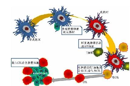 dc cik DC-CIK DC-CIK-作用，DC-CIK-表型特点