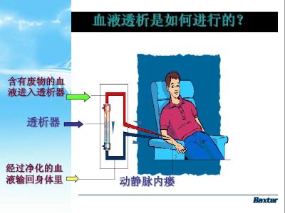 血液透析原理 透析 透析-分类，透析-主要原理