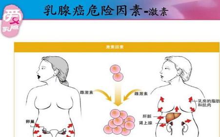 乳腺癌术后能活几年 乳腺癌的发病原因有哪些