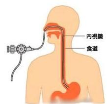 无痛胃镜麻醉有危害吗 无痛胃镜检查前注意事项