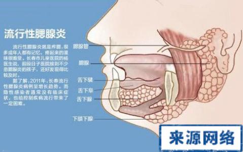 流行性腮腺炎治疗原则 流行性腮腺炎治疗