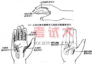 大拇指腱鞘炎症状 大拇指腱鞘炎 大拇指腱鞘炎-病因，大拇指腱鞘炎-临床症状