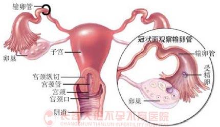 结核病流行病学调查 输卵管结核 输卵管结核-流行病学，输卵管结核-病因