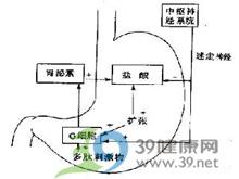 消化性溃疡的病因 消化性溃疡 消化性溃疡-简介，消化性溃疡-病因