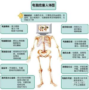 干燥综合症的症状表现 电脑综合症 电脑综合症-病理概况，电脑综合症-表现症状