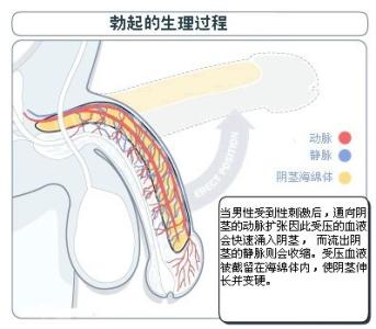 勃起功能障碍的病因 勃起功能障碍 勃起功能障碍-概述，勃起功能障碍-病因