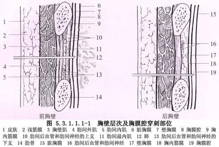 小儿胸腔穿刺适应症 胸腔穿刺术 胸腔穿刺术-适应症，胸腔穿刺术-胸膜腔积液的X线表现