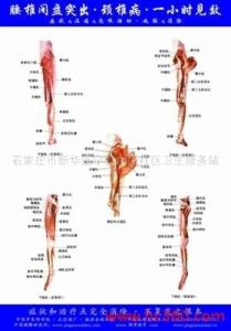 神经根型颈椎病病因 神经根型颈椎病 神经根型颈椎病-疾病概述，神经根型颈椎病-病因