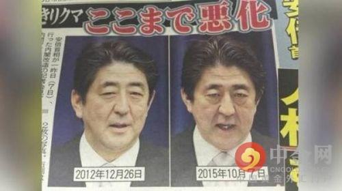 安倍晋三大肠癌晚期 安倍晋三大肠癌是真的吗？