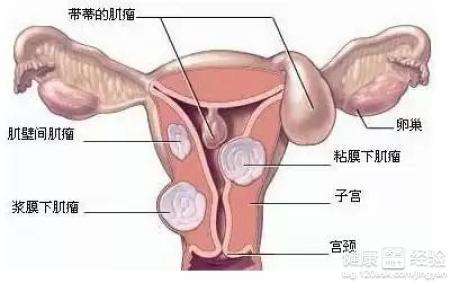 保养子宫的最好方法 吃什么对子宫好